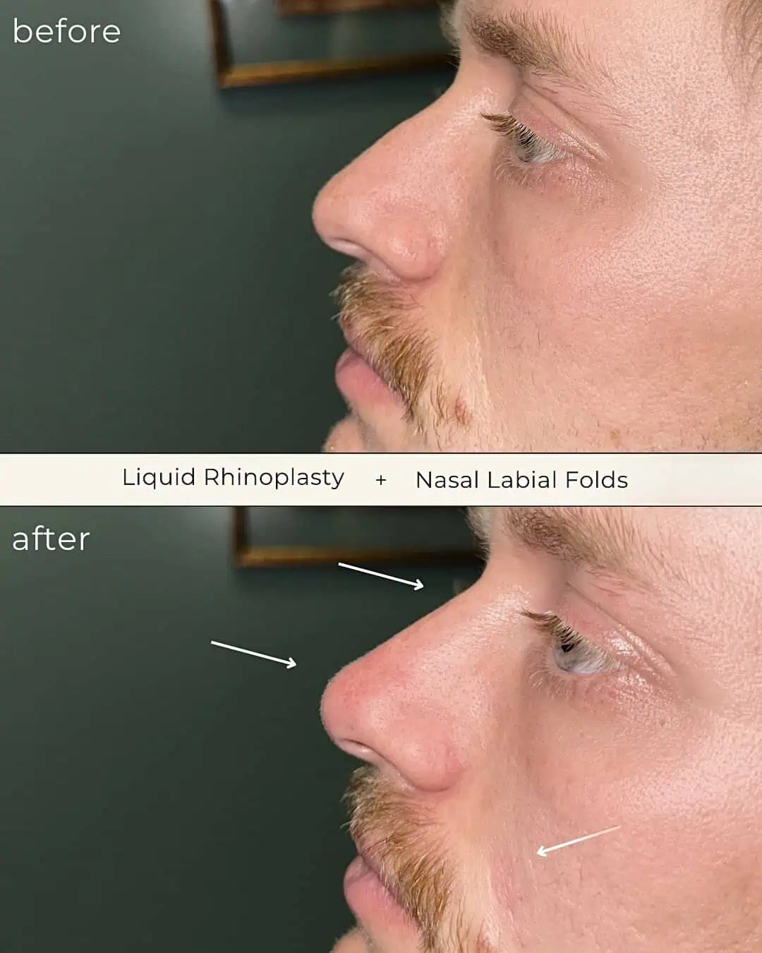 DermaCure of Valencia Expert Dermal Fillers in Valencia, CA