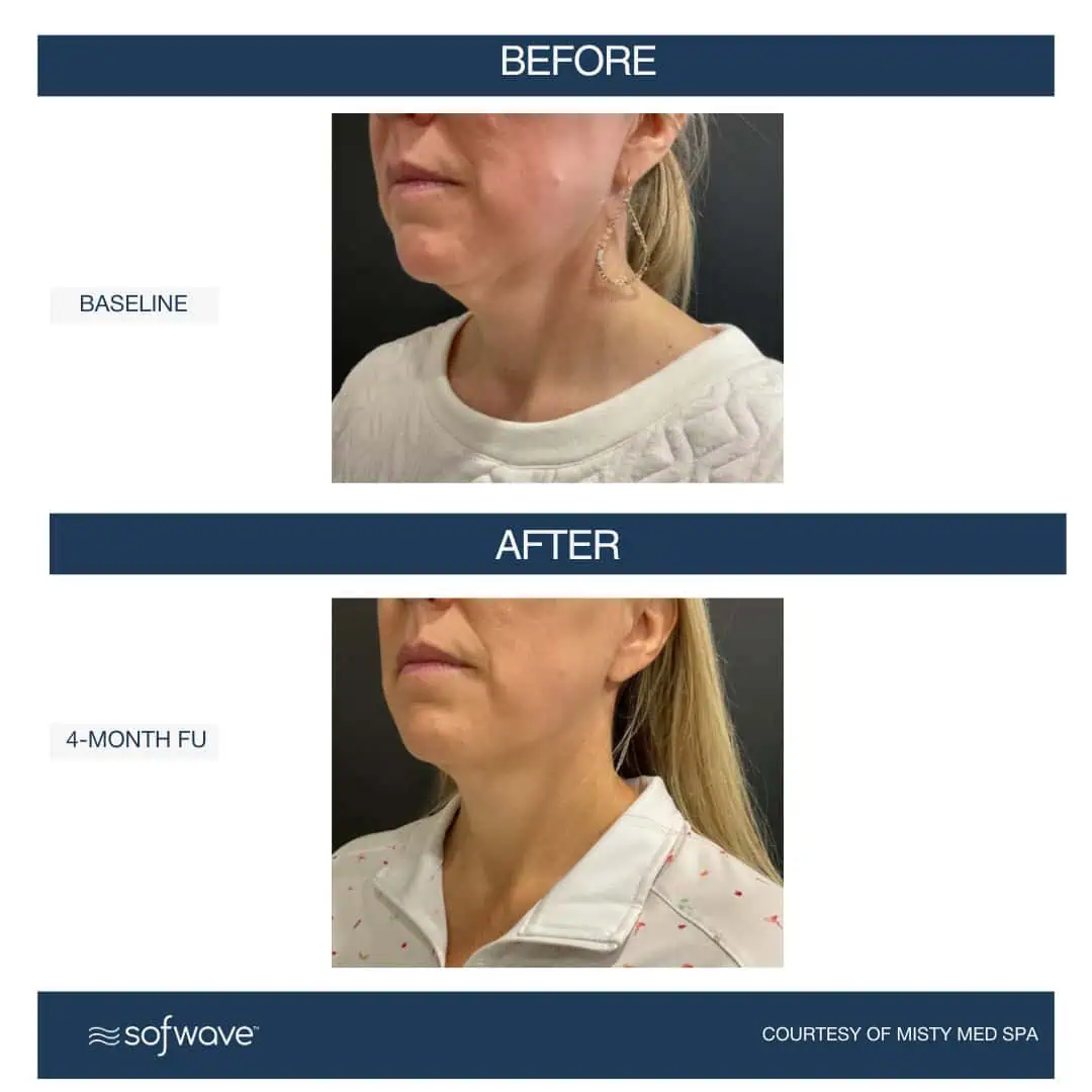 Set-109-Face-Neck