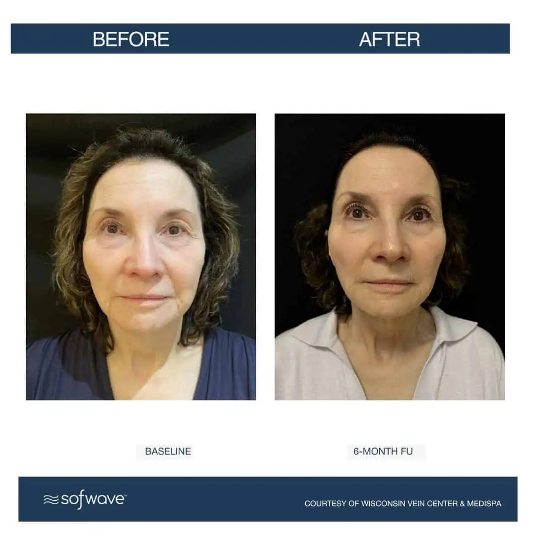 Set-64-Full-Face