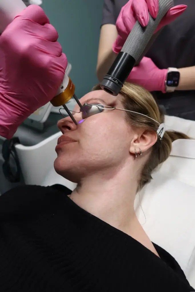 PICO Genesis in Valencia, CA 1 DermaCure of Valencia PICO Genesis in Valencia, CA