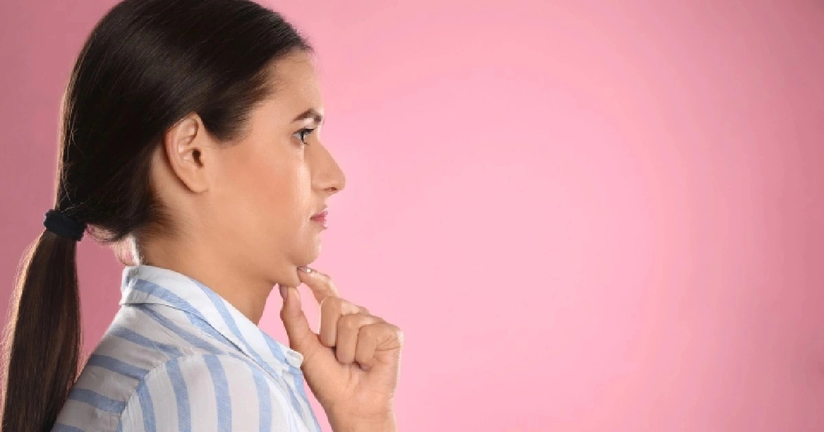 womenr receiving Kybella® in Valencia, CA