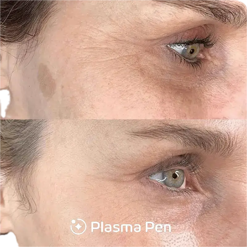 a close up of a woman's face