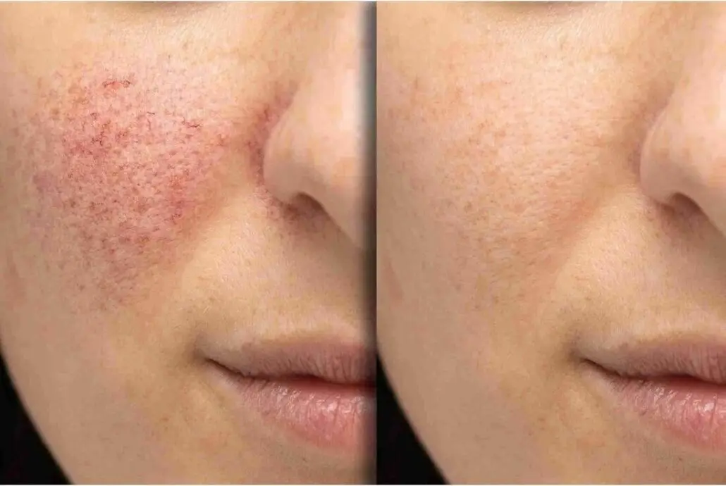 a close up of a woman's face